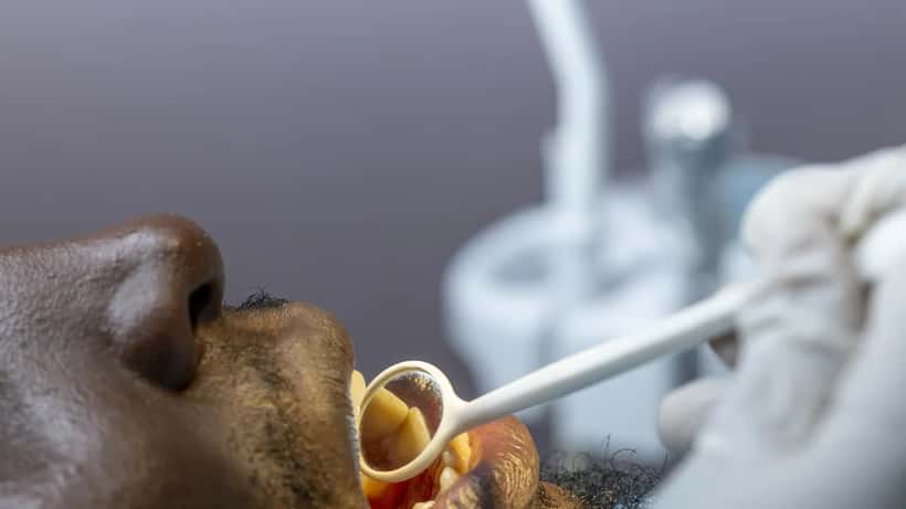 Dentiste examinant les dents d'un patient, illustrant l'importance du Régime canadien de soins dentaires